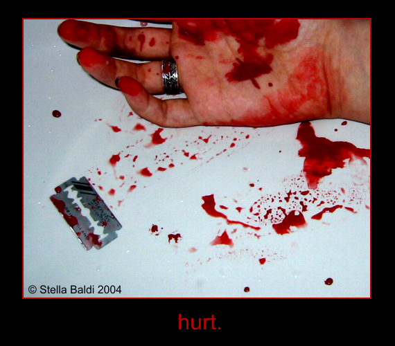 Hurt